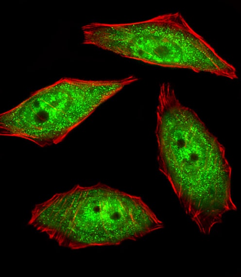 NEK2 Antibody