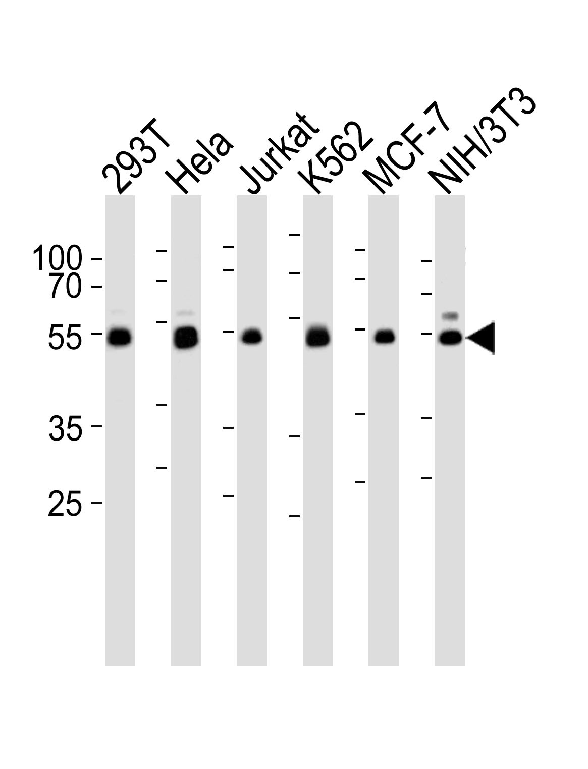 NEK2 Antibody