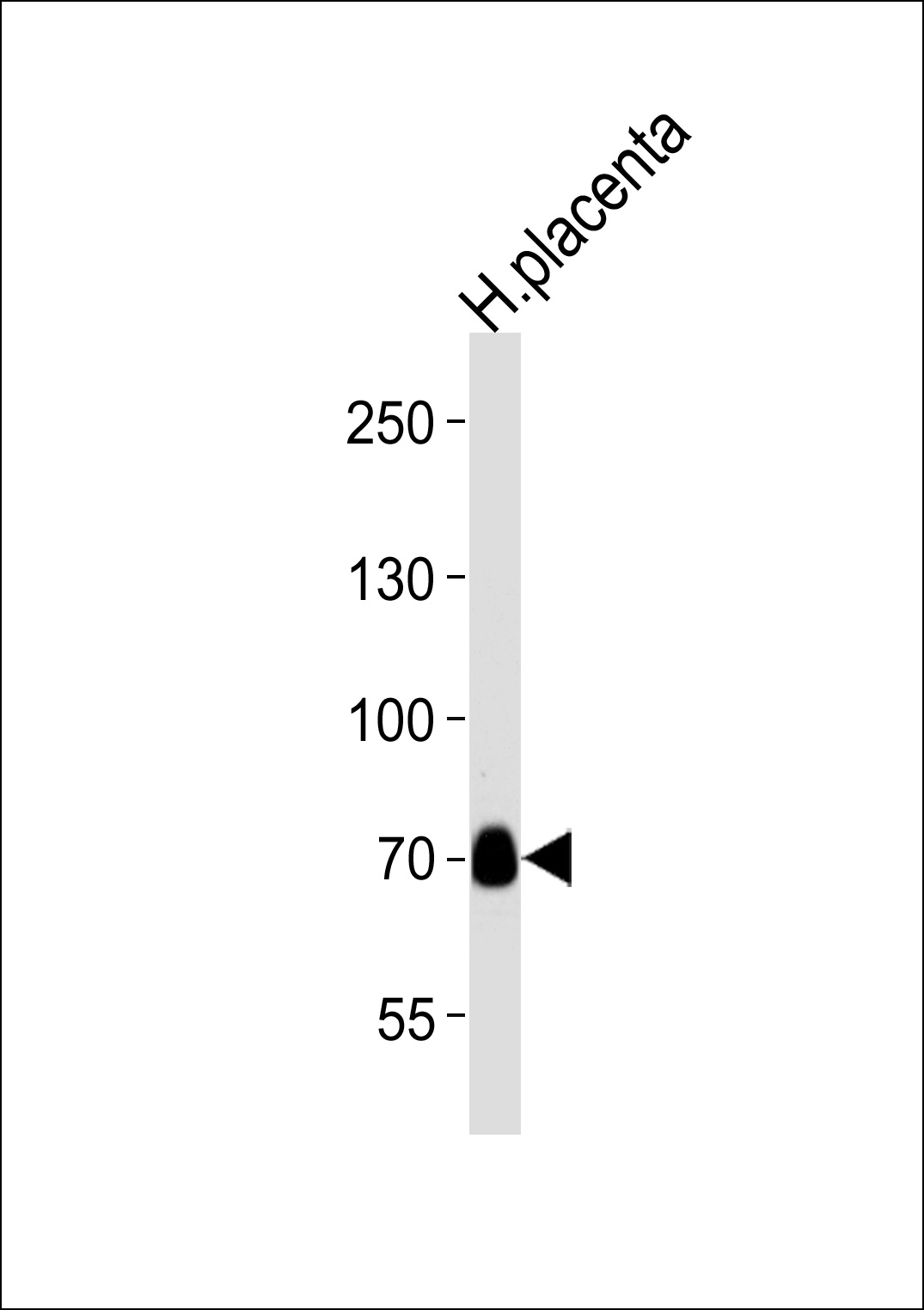 NEK11 Antibody