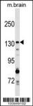 GAK Antibody