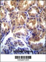 TRPM6 Antibody