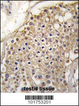 PIP5K2G Antibody