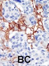PIP5K2B Antibody