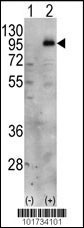 PIP5K1C Antibody