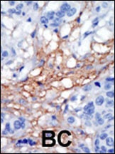 PIP5KI gamma Antibody