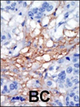 PIP5K1C Antibody