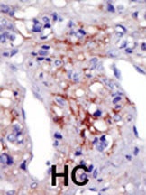 PIP5KI gamma Antibody