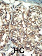 PI 4 Kinase type 2 beta antibody