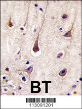 PIK3R2 Antibody