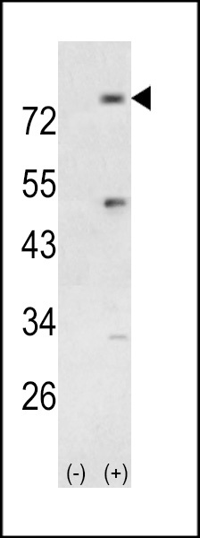 PIK3R5 Antibody