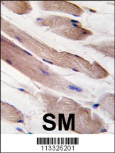 PIK3R1 Antibody