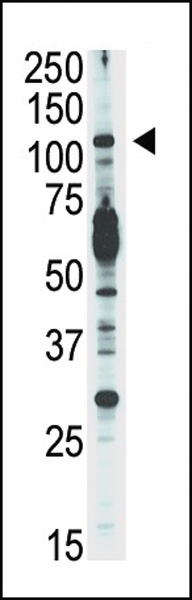 PI3KCD Antibody