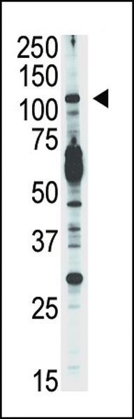 PIK3CD Antibody