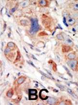 PI3KCD Antibody