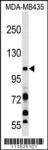 PIK3CB Antibody