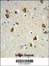 RPS6KB2 Antibody