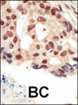 cGKII Antibody