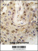 PRKG2 Antibody