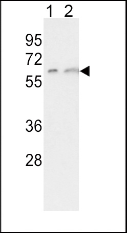 CYP7A1 Antibody