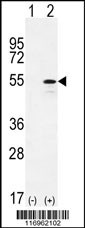 CYP26B1 Antibody