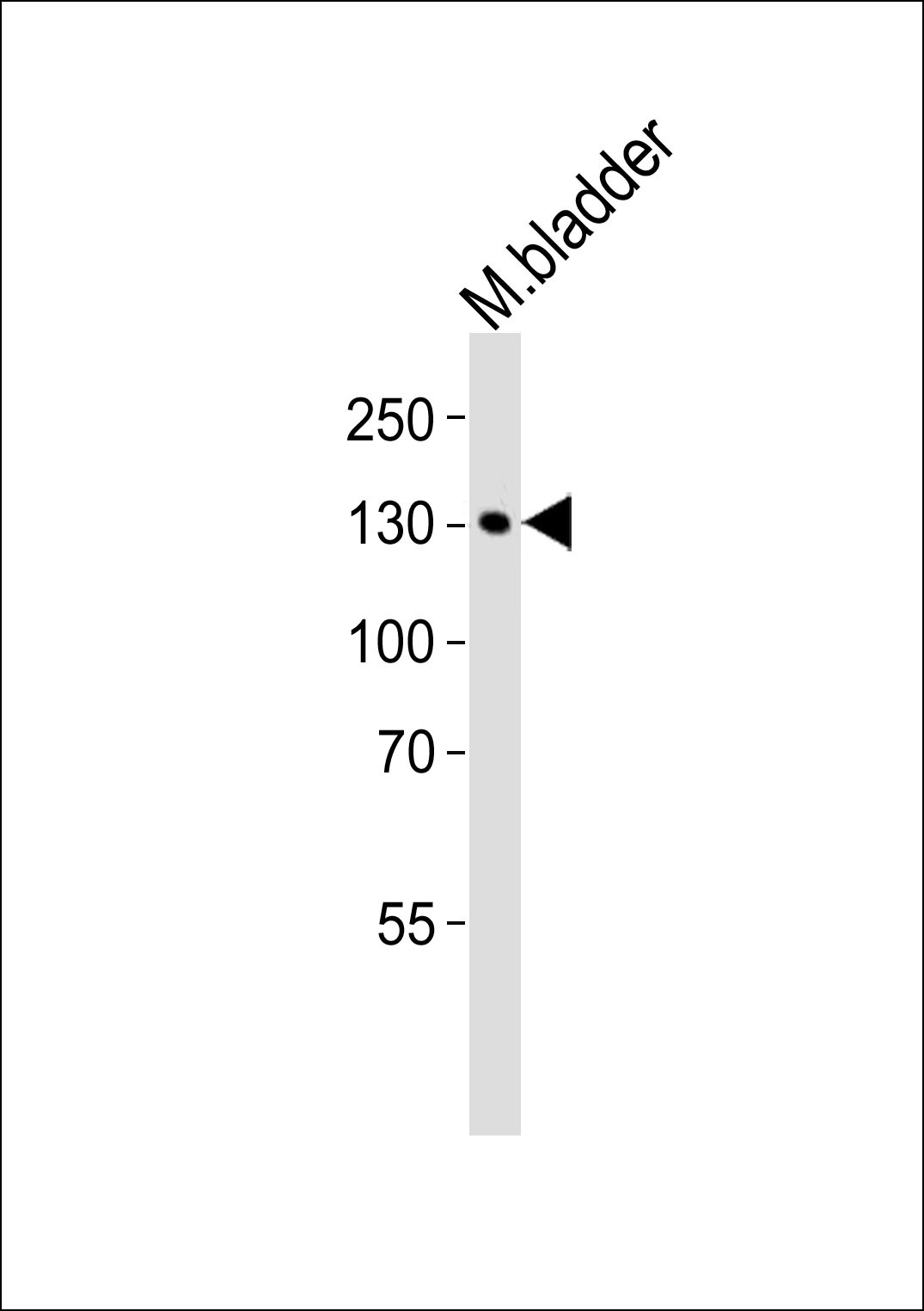 MLCK Antibody