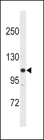 MYLK Antibody