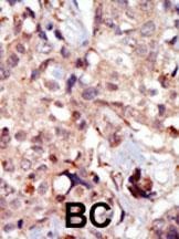 MLCK Antibody