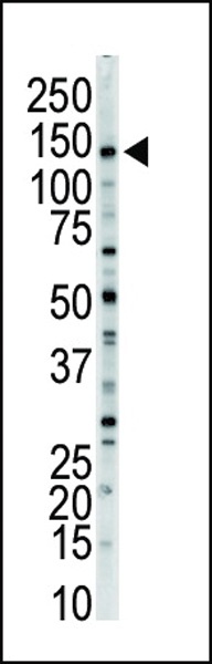 MYLK Antibody