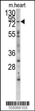 MYLK3 Antibody