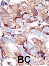 MYLK3 Antibody