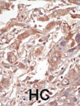 LOK Antibody