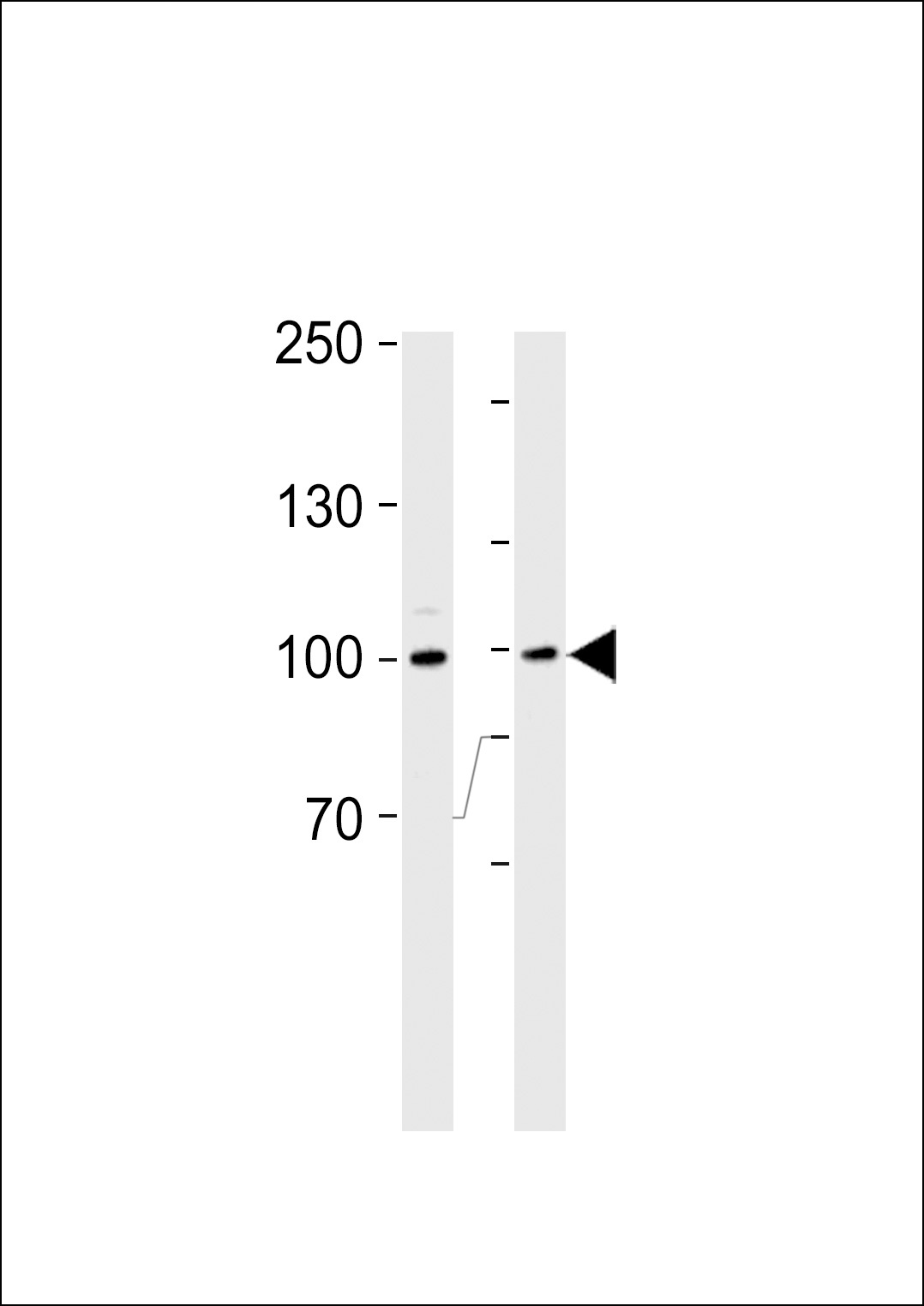 RPS6KA3 Antibody
