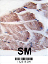 RPS6KA3 Antibody