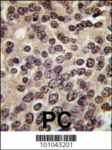 PKN beta Antibody
