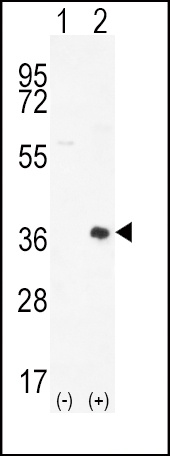 PIM2 Antibody