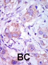 MLK1 Antibody