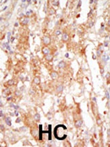 MEKK6 Antibody