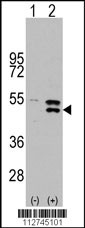 MAP2K5 Antibody