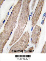 MAP2K5 Antibody
