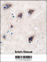 CYP2R1 Antibody