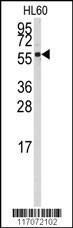 CYP4Z1 Antibody