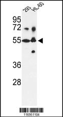 CYP21A2 Antibody