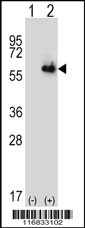 ALDH4A1 Antibody