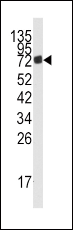 AMPD3 Antibody