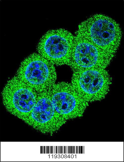 FKBP1B Antibody