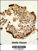 HSP90AB1 Antibody