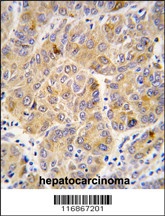 ALDH9A1 Antibody