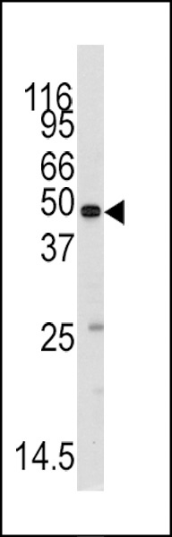 Methionyl tRNA Synthetase Antibody