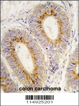Methionyl tRNA Synthetase Antibody