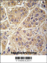 SARS2 Antibody